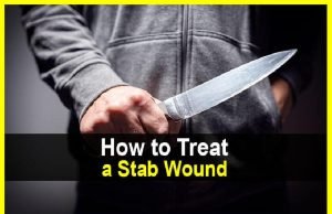 How to Treat a Stab Wound