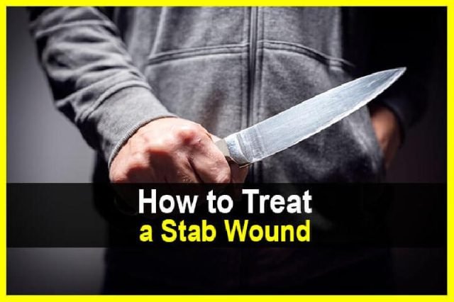 HowtoTreataStabWound