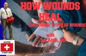 VIDEO: How Wounds Heal